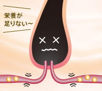 栄養が足りない〜