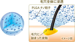 毛穴全体に浸透 PLGAナノ粒子 毛穴に詰まった皮脂 イメージ図
