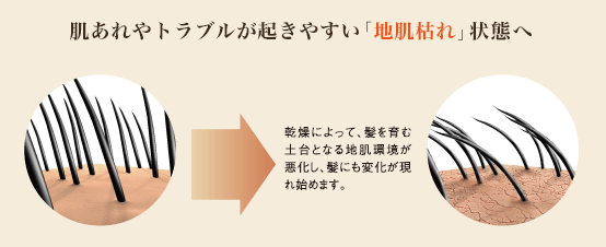 肌あれやトラブルが起きやすい「地肌枯れ」状態へ　乾燥によって、髪を育む土台となる地肌環境が悪化し、髪にも変化が現れ始めます。